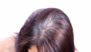 نصائح لعلاج مشكلة تساقط الشعر بعد الولادة