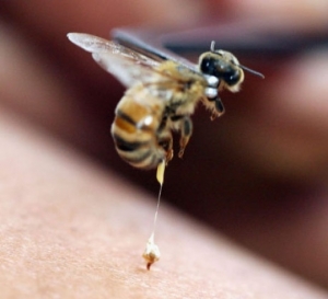 العلاج بسم النحل! لن تصدقوا الأمراض التي تعالجها لسعة النحلة   