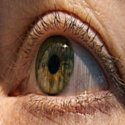 نجاح تجربة لاستخدام المغناطيس في السيطرة على ارتعاش العين