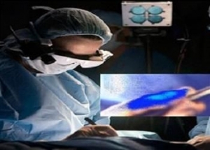 "نظارات" تُمكّن الجراحين من تمييز الخلايا السرطانية