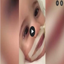 بالفيديو... طفلة تستيقظ أثناء مناقشة الأطباء إيقاف أجهزة الدعم عنها