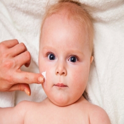 علاج الاكزيما عند الاطفال والوقاية منها
