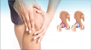 دراسة تكشف عن العلامة الأولى للإصابة بالتهاب مفصل الركبة.