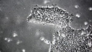علماء بهارفارد يطورون خلايا جذعية قاتلة للسرطان.